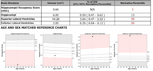 Cortechs.ai | Predicting progression of MCI