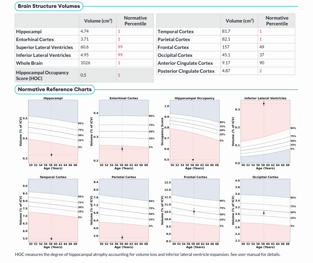 Cortechs.ai | Understanding the Hippocampal Occupancy Score