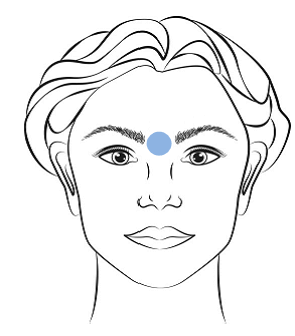 patient positioning at glabellar