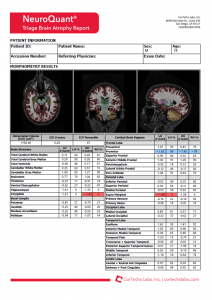 Cortechs.ai | Understanding NeuroQuant Reports