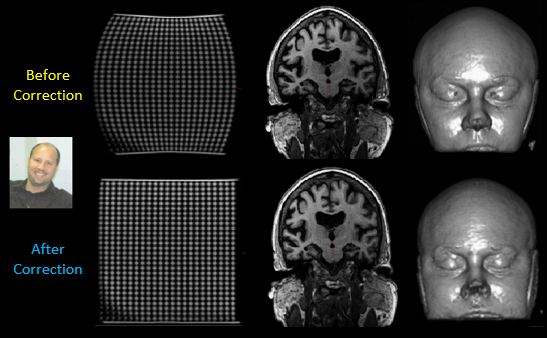 Cortechs.ai | MR Image Standardization: Quality, Consistency and Spatial Integrity spatial_distortion.png