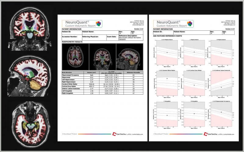 Cortechs.ai | Custom report setup - quick, easy and personalized