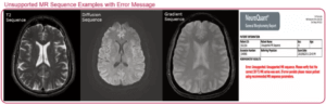 MRI Scan Repeated