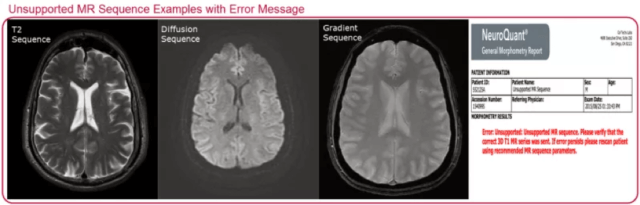 difference between c t scan and mri