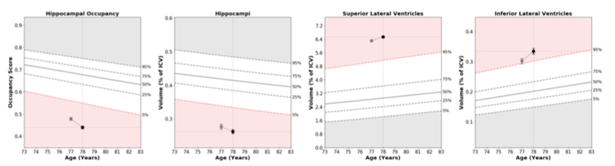 Age- and Sex-matched charts