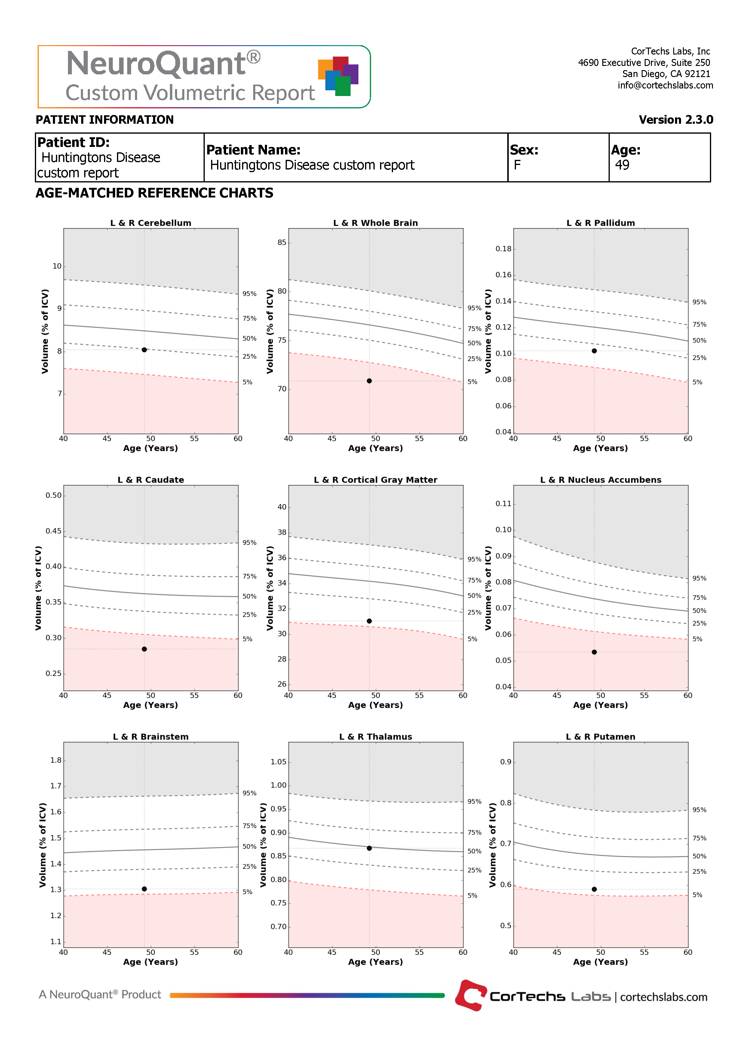 Cortechs.ai | The Role of Volumetric Neuroimaging in the Evaluation of Huntington’s Disease