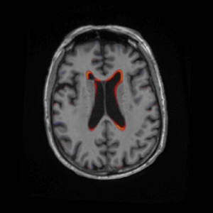 NQChange Visualization Axial