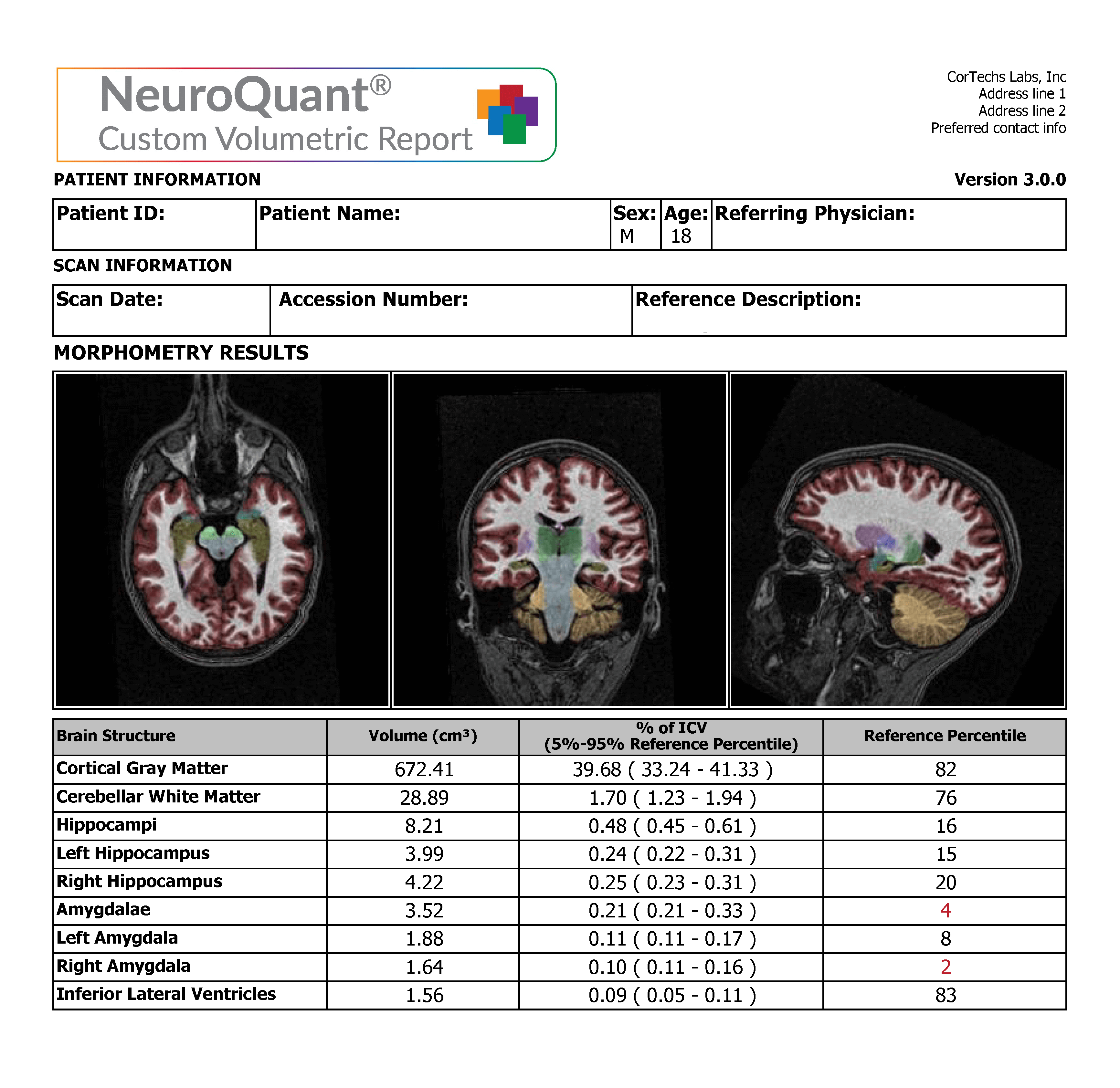NeuroQuant Custom Report