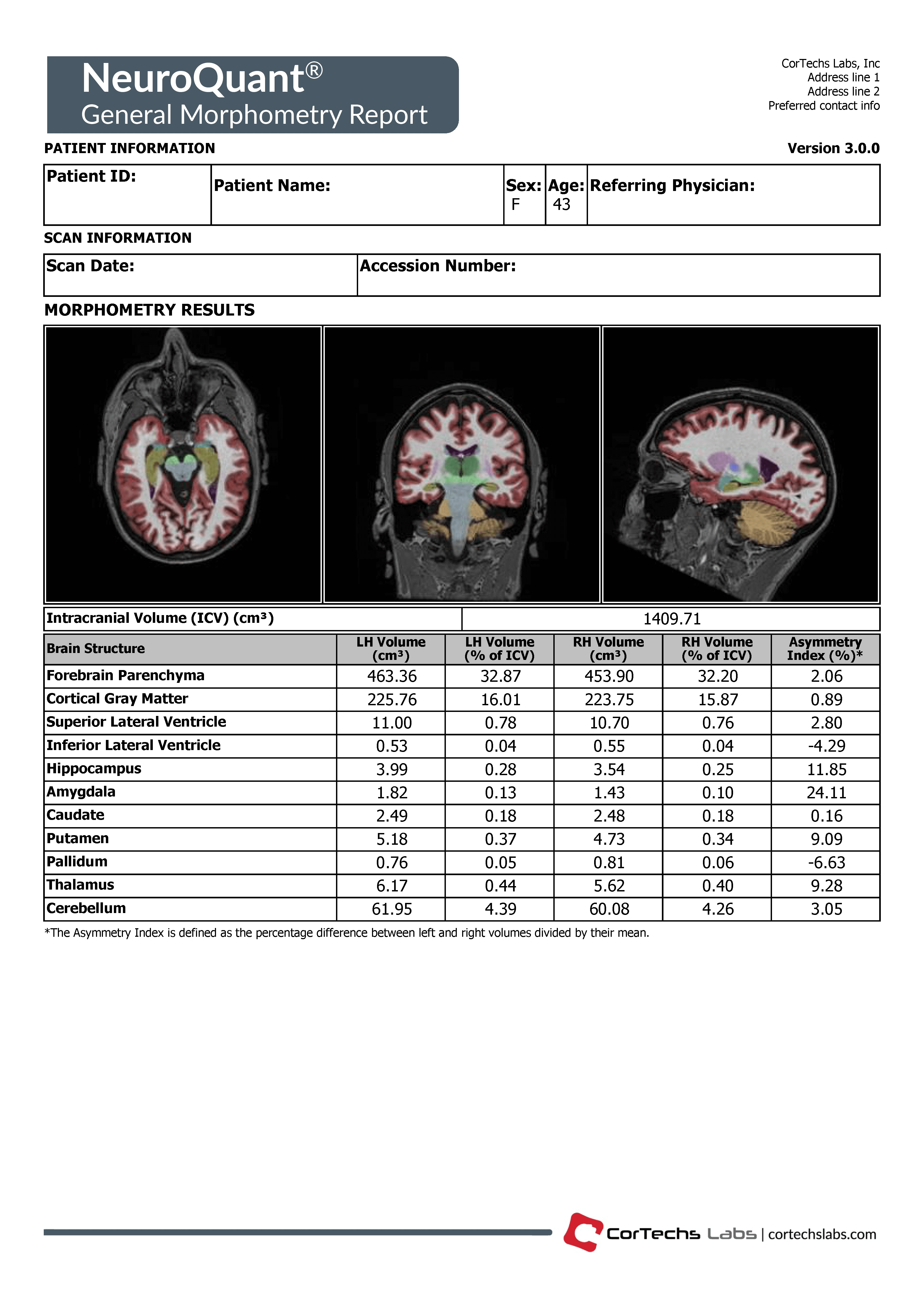 General Morphometry Report