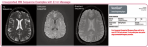 Cortechs.ai | When to repeat an MRI scan for NeuroQuant<sup>®</sup>