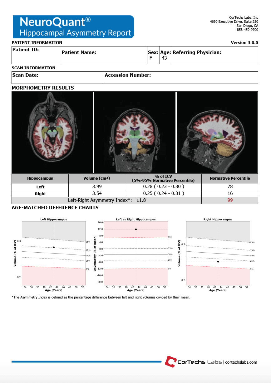 NeuroQuant Hippocampal Asymmetry Report