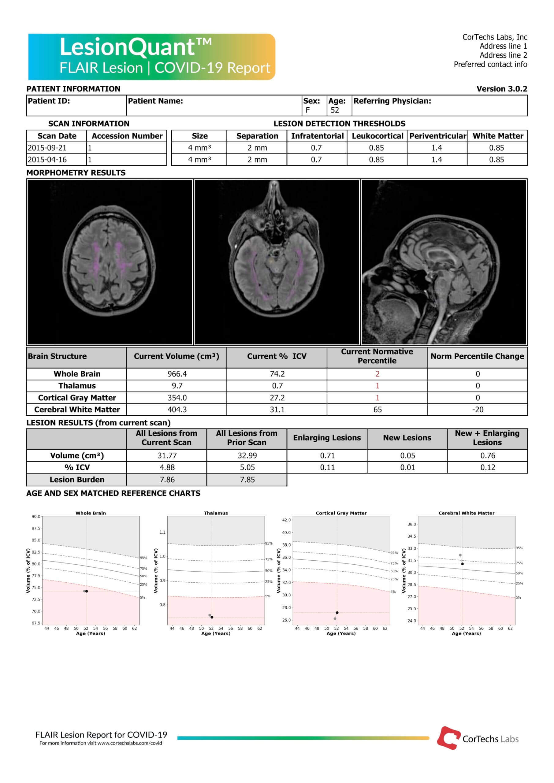 Cortechs.ai | Brain volumetrics reveal possible COVID-19 neurological manifestations