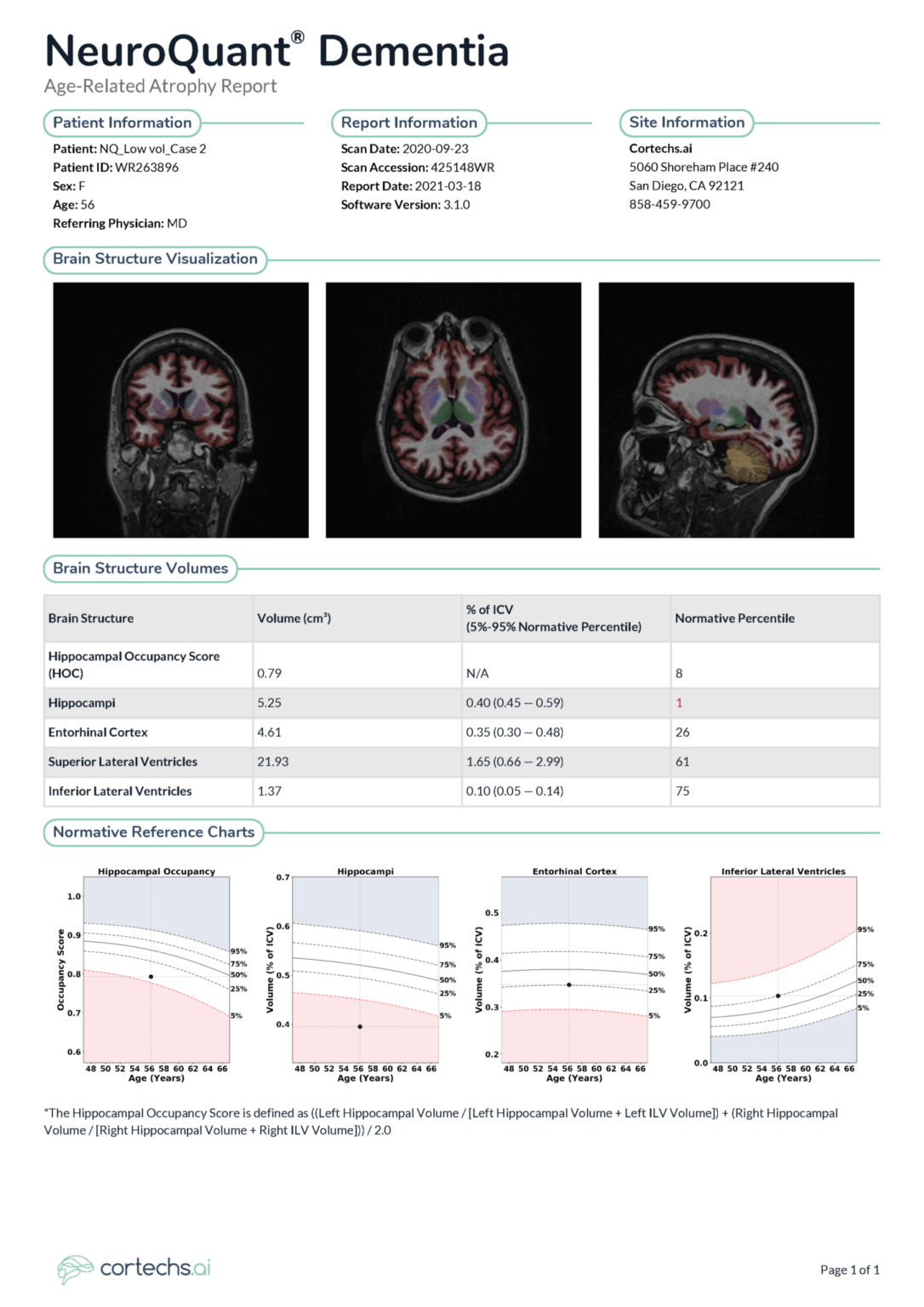 Early and accurate diagnosis of Alzheimer’s disease - Cortechs.ai