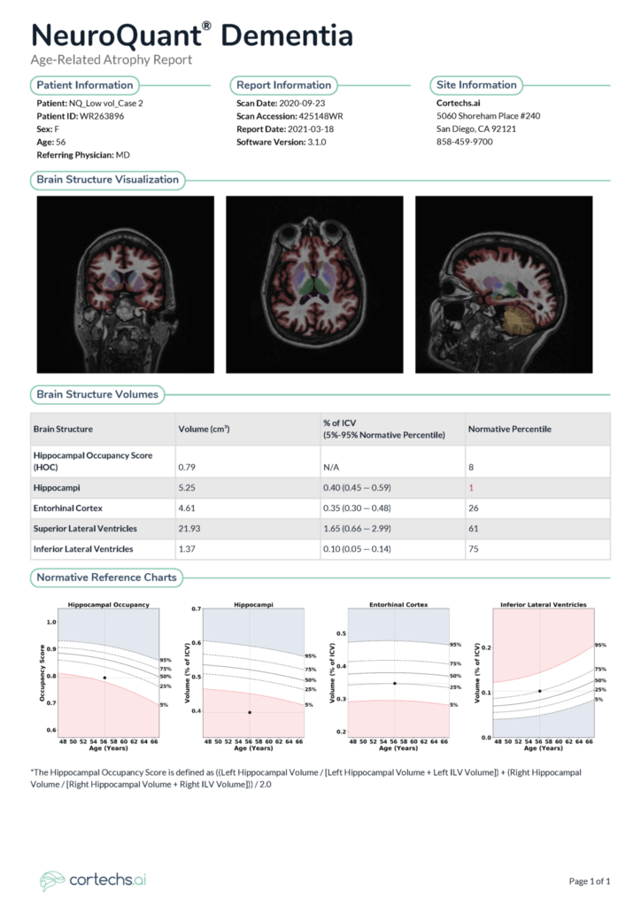Cortechs.ai | Early and accurate diagnosis of Alzheimer’s disease