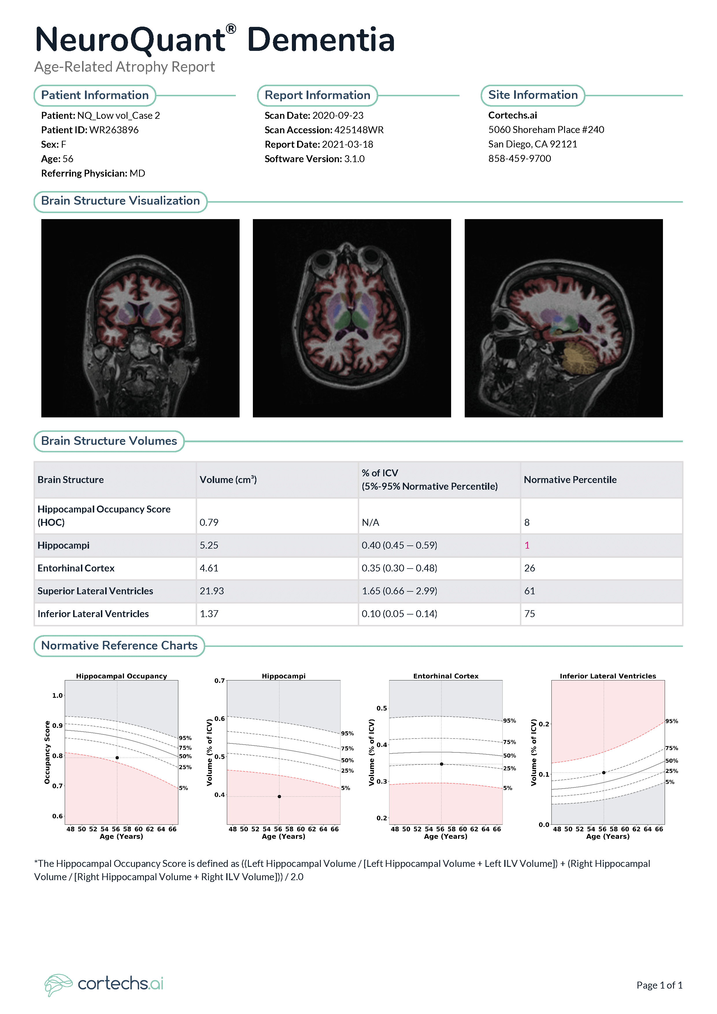 Early and accurate diagnosis of Alzheimer's disease