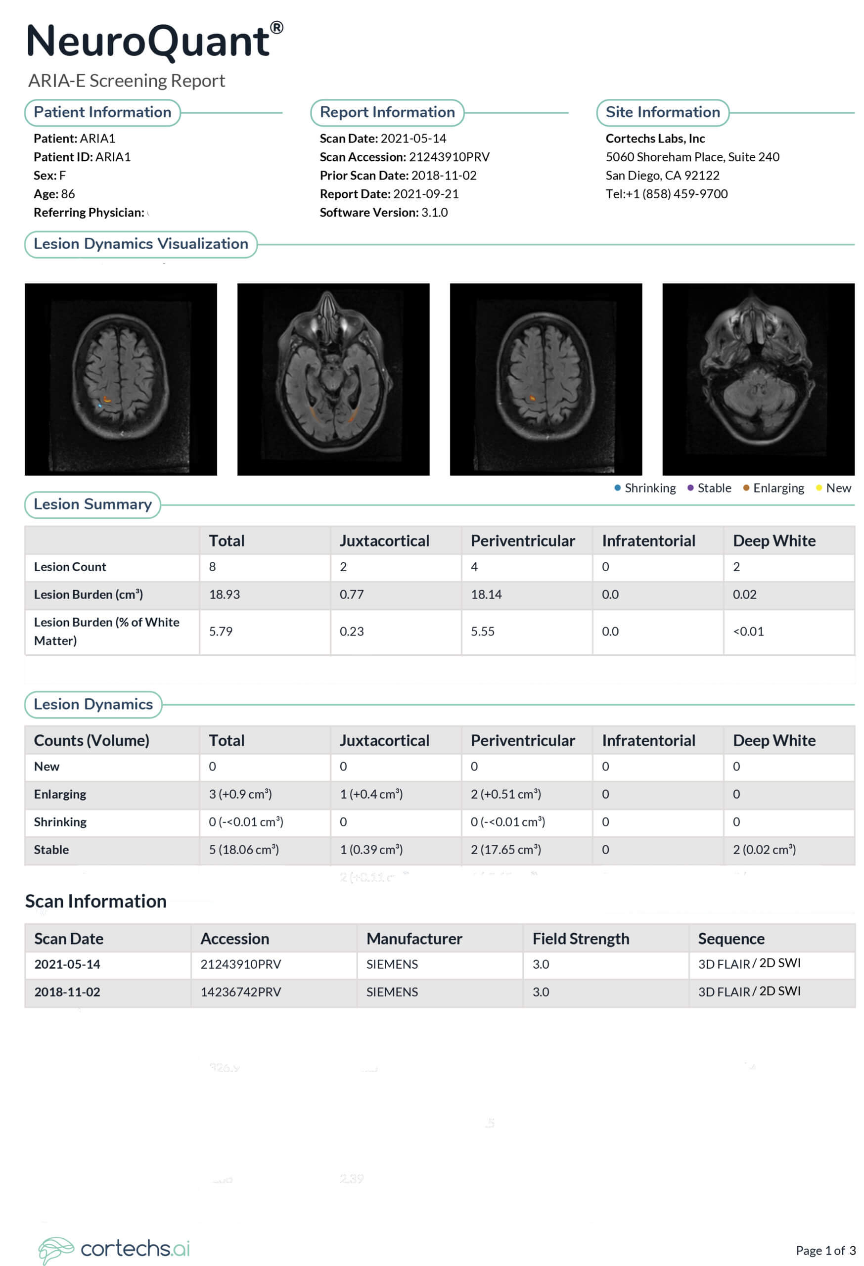 NeuroQuant ARIA E Report