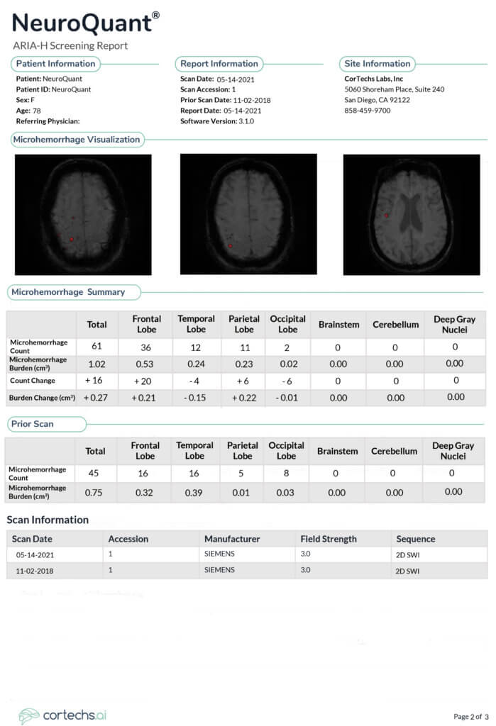 NeuroQuant ARIA H Report