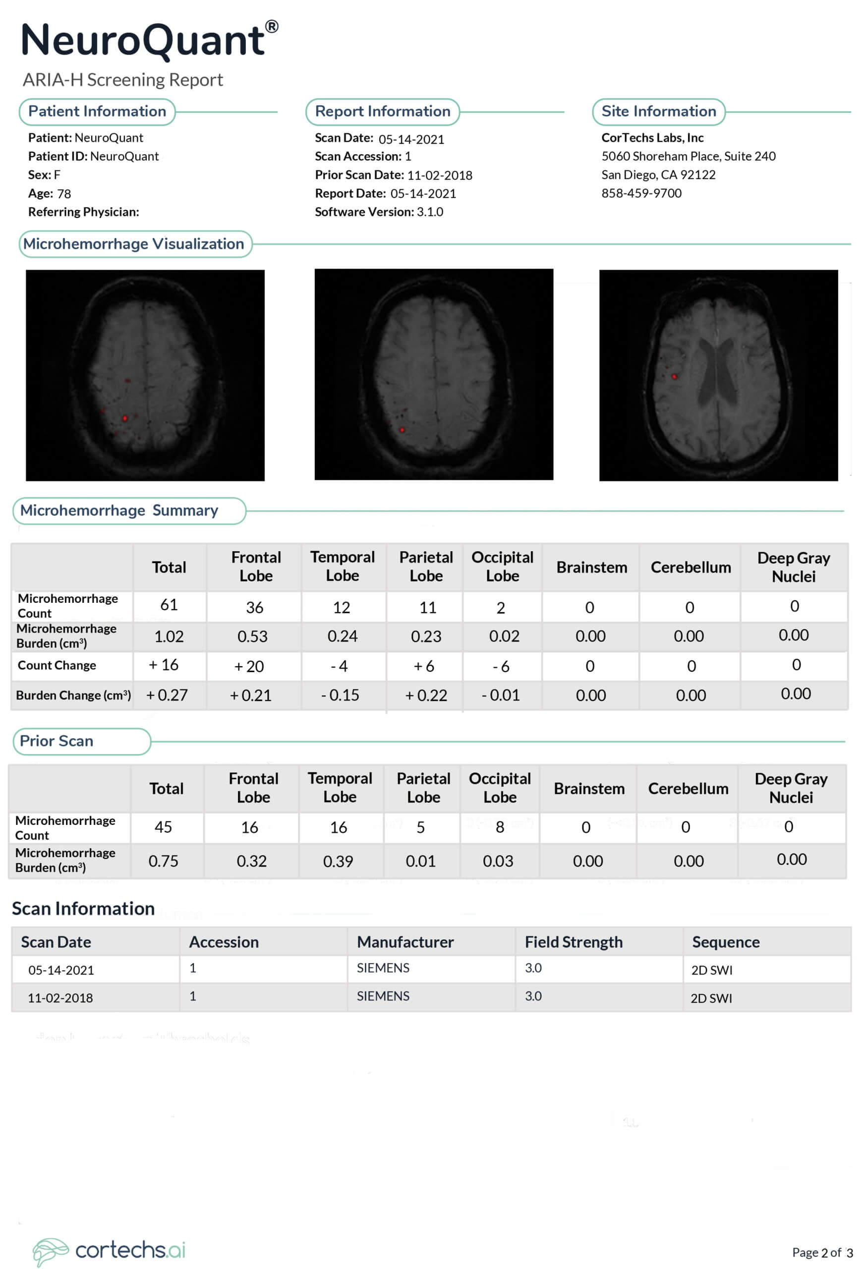 NeuroQuant ARIA H Report