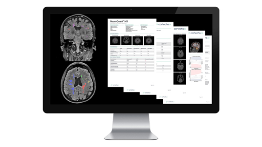 Cortechs.ai | Comprehensive volumetric MRI for the clinical assessment of multiple sclerosis