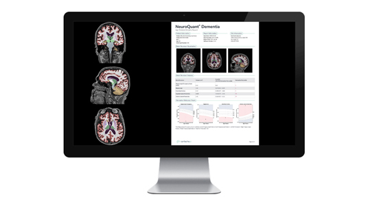 Cortechs.ai | Early and accurate diagnosis of Alzheimer’s disease