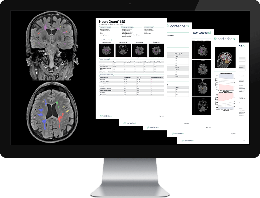 Comprehensive Volumetric MRI for the Clinical Assessment of Multiple Sclerosis