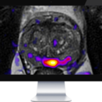 OnQ™ Prostate high-contrast output