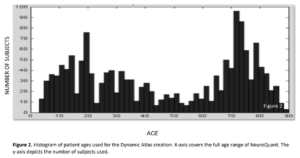 Histogram of patient ages used for Dynamic Atlas™ creation. 