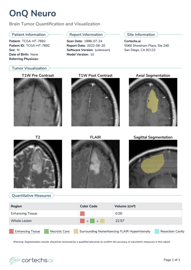 Example OnQ™ Neuro Report showcasing a low-grade glioma case.