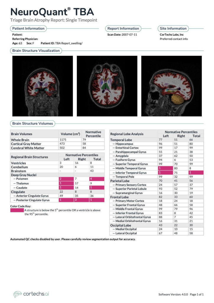 NeuroQuant TBA report