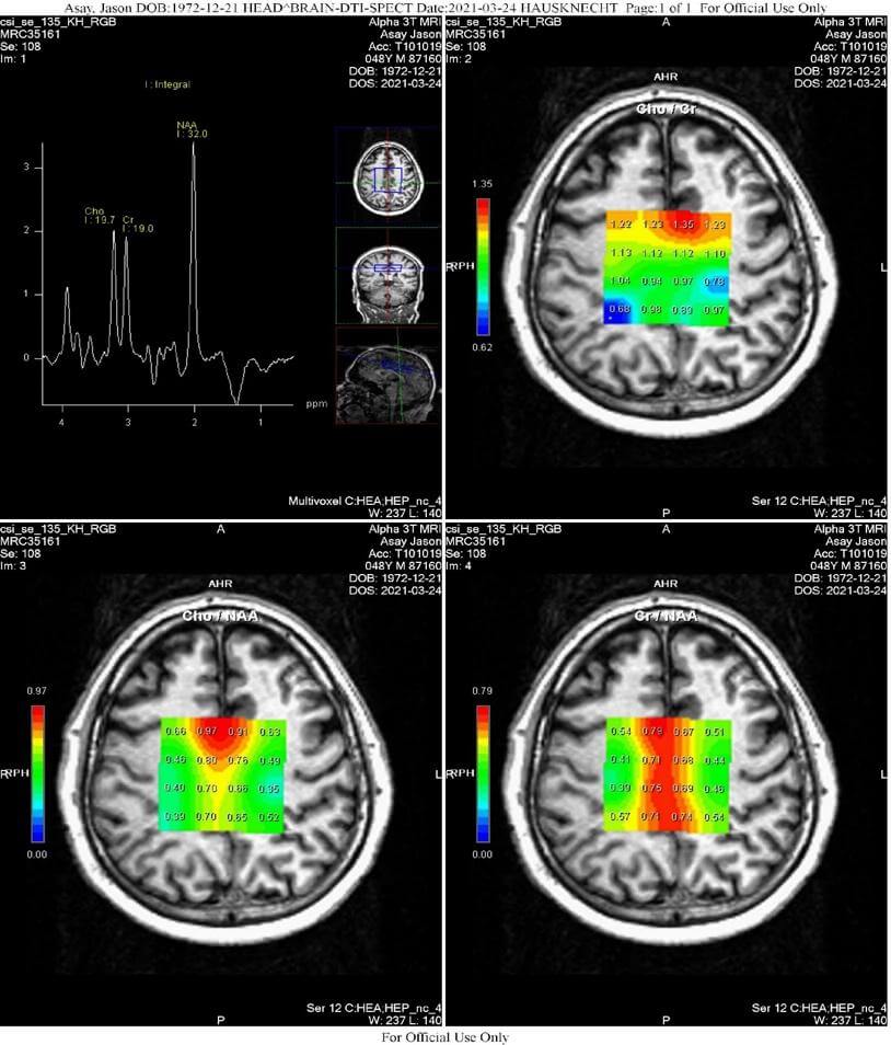 2D-CSI Spectroscopy (Chemical Shift Imaging)