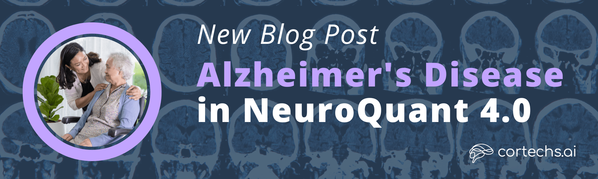 Identifying Alzheimer’s Disease With NeuroQuant 4.0