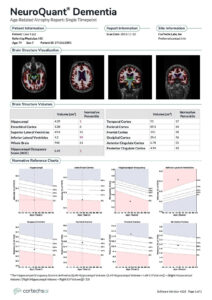 NeuroQuant Dementia report