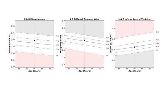 Cortechs.ai | Our Normative Database