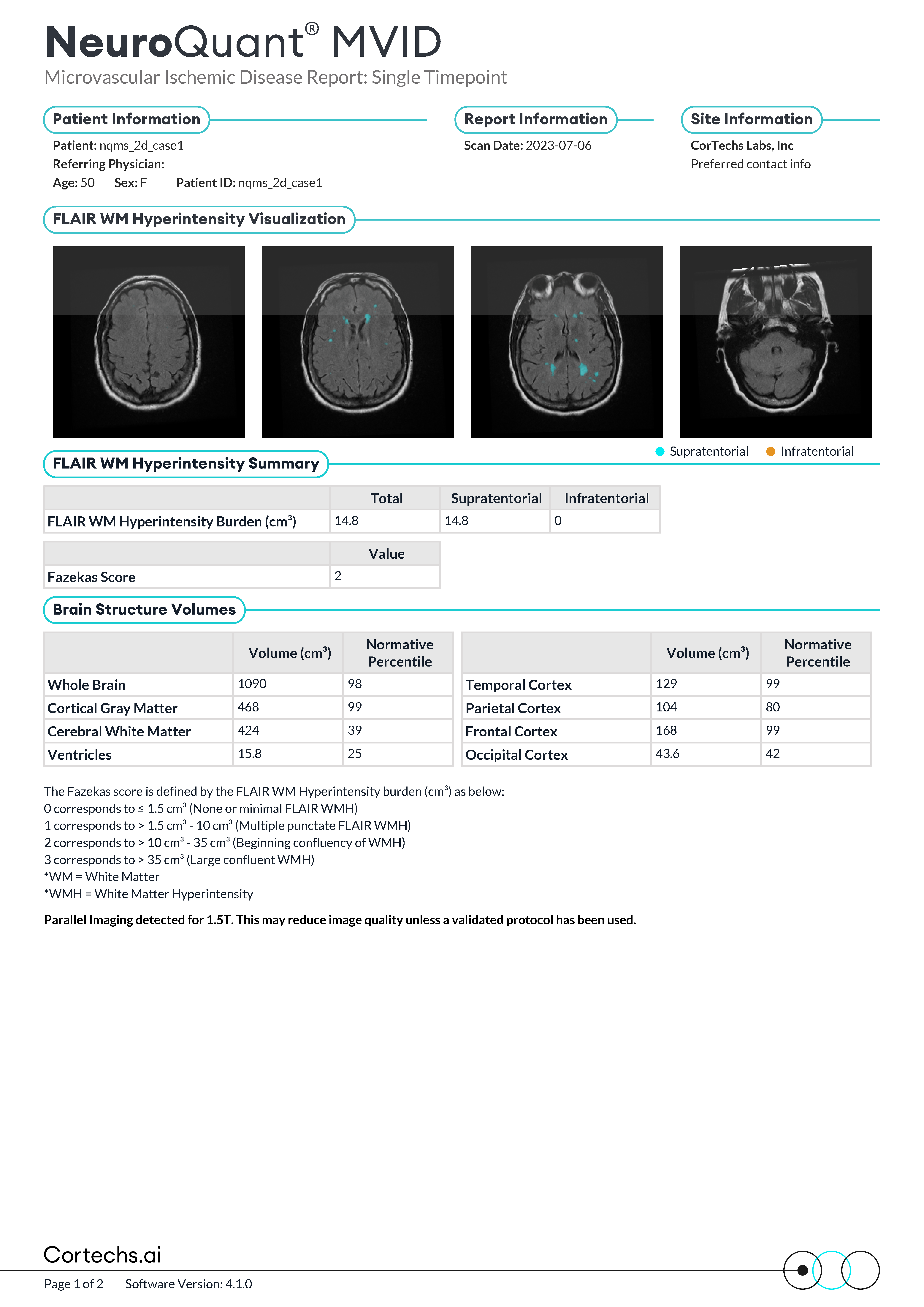 Cortechs.ai | NeuroQuant MVID Report: Fazekas Score