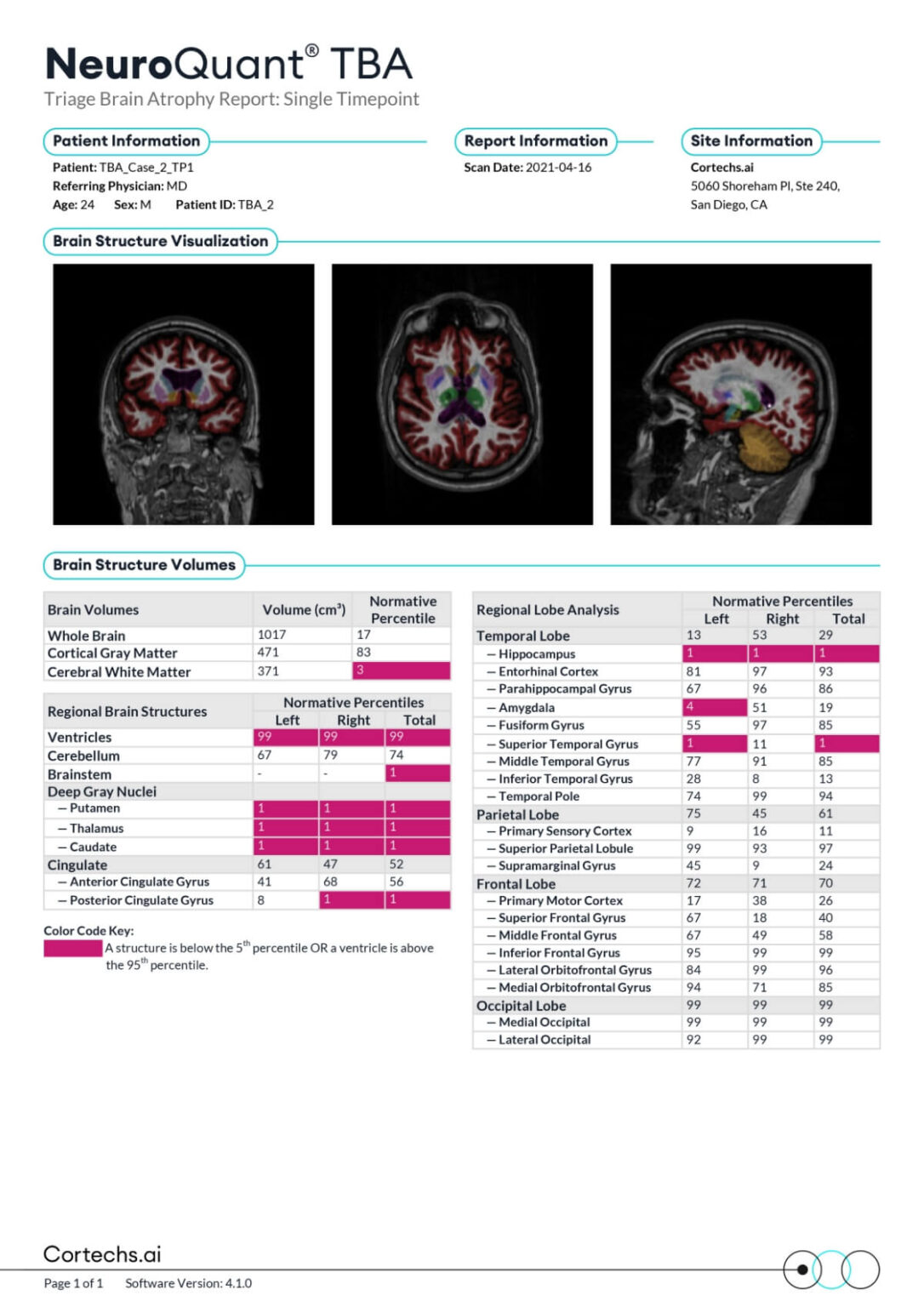 Neurowquant NeuroQuant - Cortechs.ai