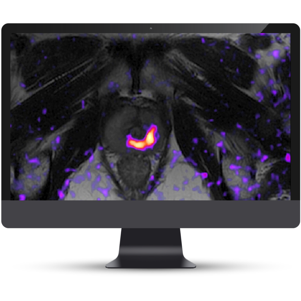 Cortechs.ai|Solutions