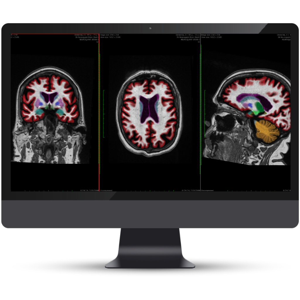 Cortechs.ai|Solutions