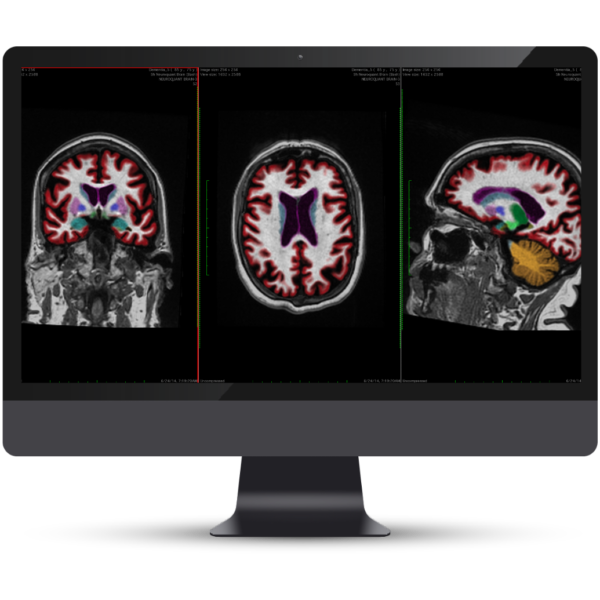 Solutions - Cortechs.ai