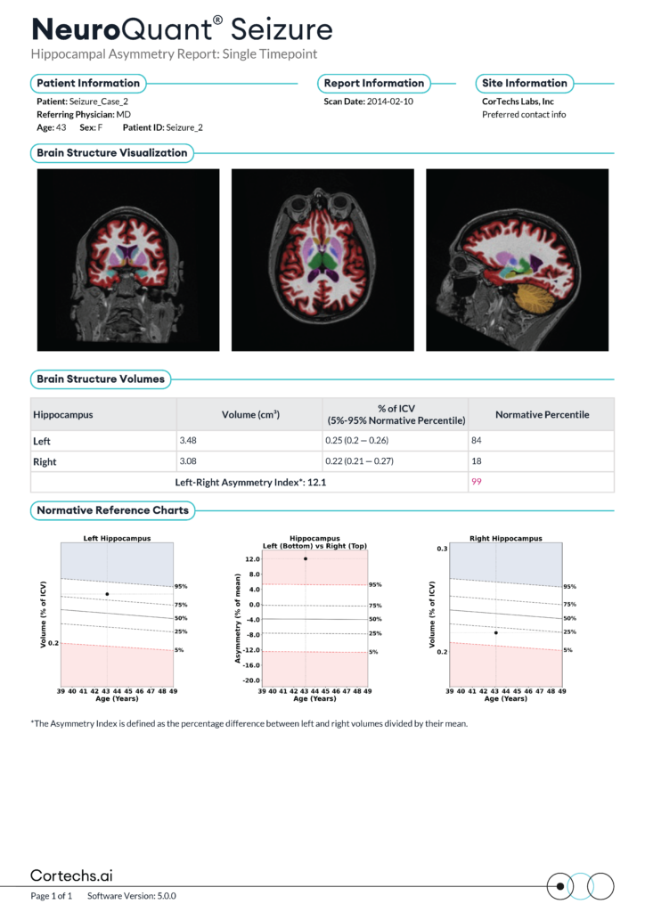 Cortechs.ai | Epilepsy Care with NeuroQuant Seizure: The Power of Quantifying Hippocampal Asymmetry