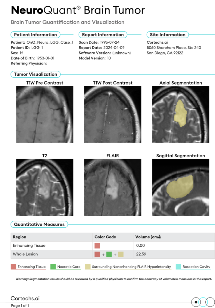 NeuroQuant Brain Tumor - Cortechs.ai