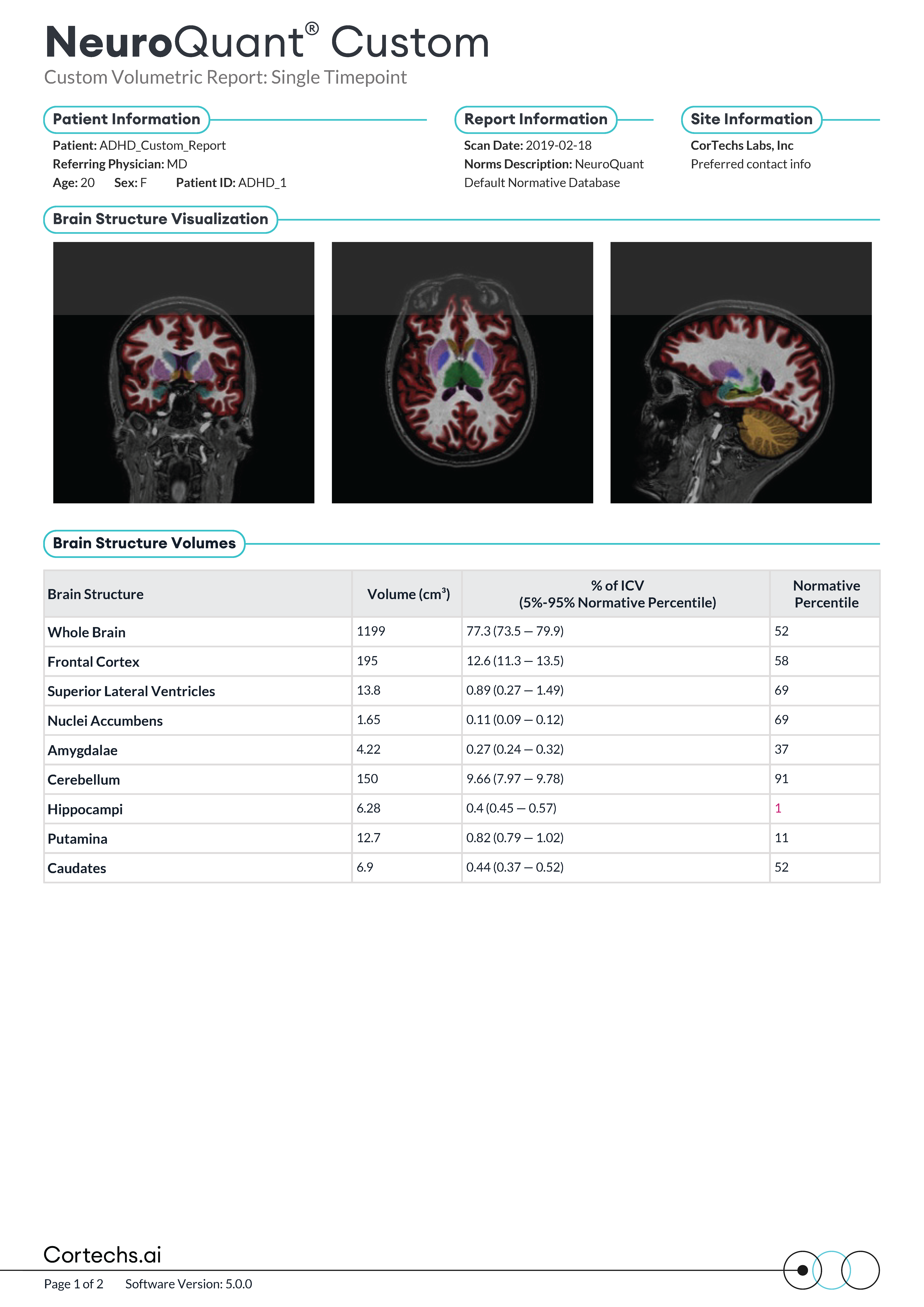 Cortechs.ai | All the Ways to Use the NeuroQuant Custom Report