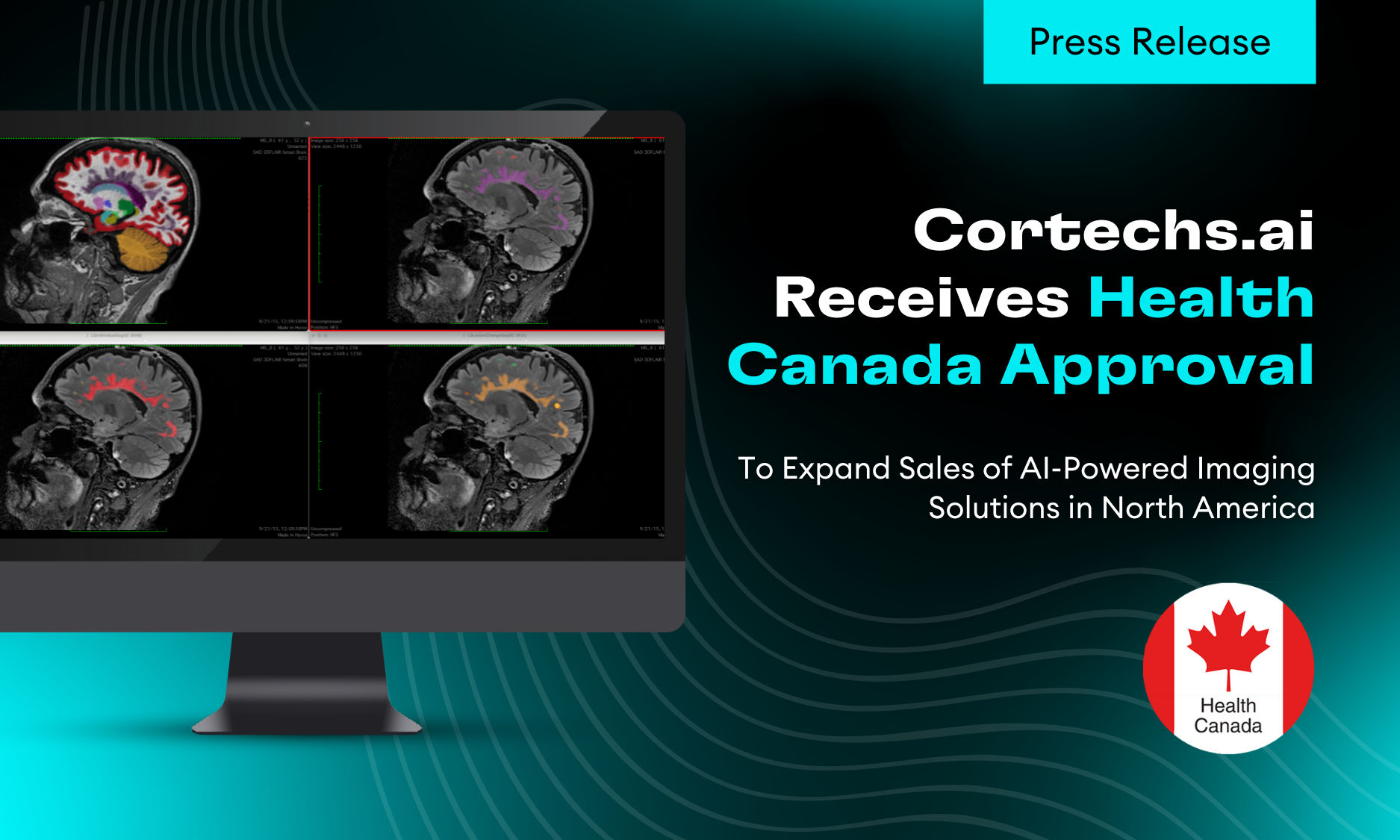 Cortechs.ai|Cortechs.ai Receives Health Canada Approval to Expand Sales of AI-Powered Imaging Solutions in North America