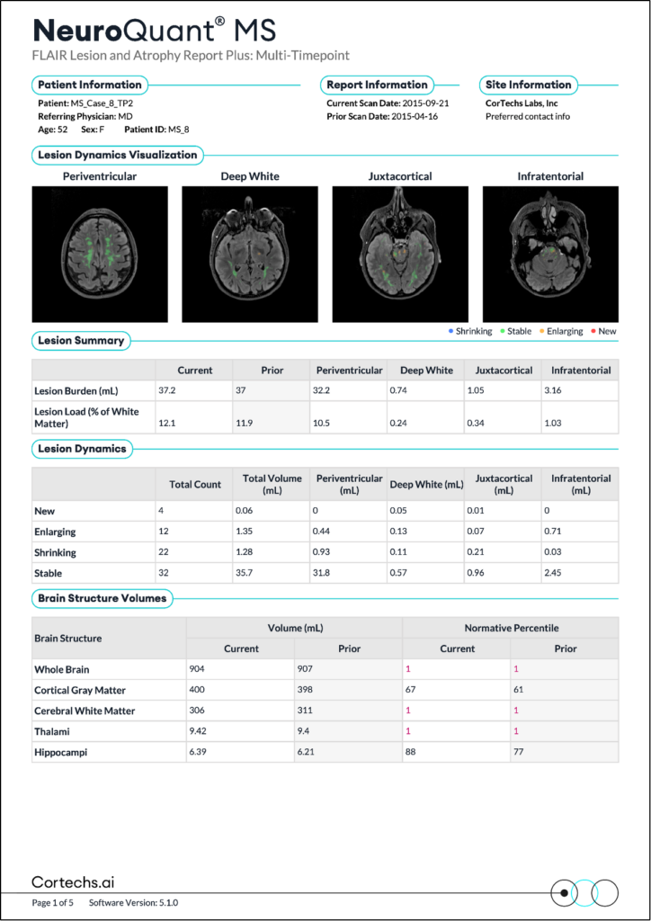 Cortechs.ai | Introducing NeuroQuant MS Lesion Dynamics Computation: A Clearer Path to Understanding Disease Progression
