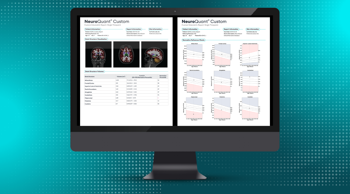 Cortechs.ai|All the Ways to Use the NeuroQuant Custom Report