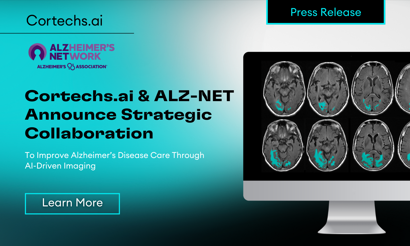 Cortechs.ai|Cortechs.ai and ALZ-NET Announce Strategic Collaboration to Improve Alzheimer’s Disease Care Through AI-Driven Imaging
