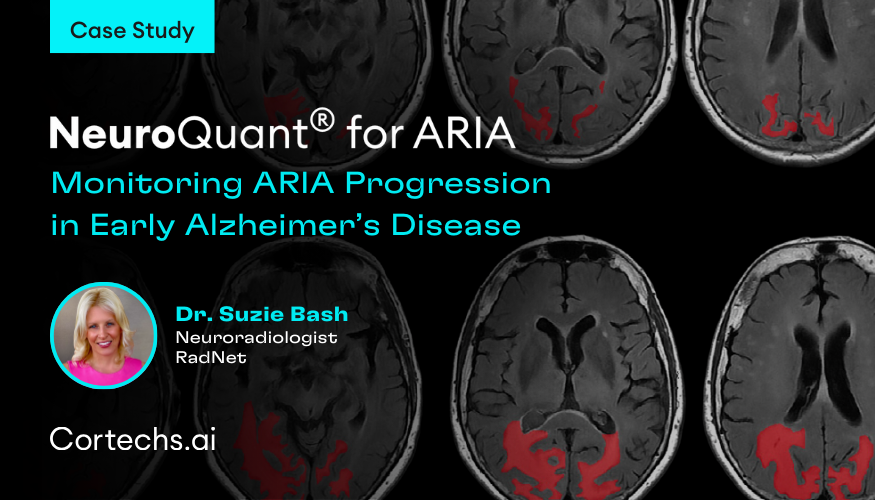 Cortechs.ai | Case Study: NeuroQuant® for ARIA: Monitoring ARIA Progression in Early Alzheimer’s Disease