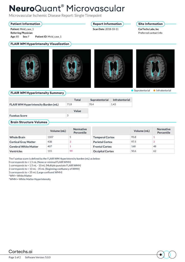 Cortechs.ai | Understanding Microvascular Ischemic Disease and the Value of NeuroQuant Microvascular Reports