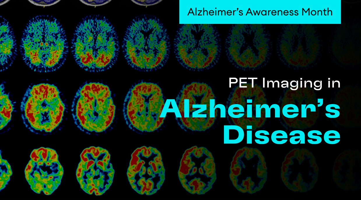 Cortechs.ai | Seeing Alzheimer’s More Clearly: How PET Imaging Is Changing the Game