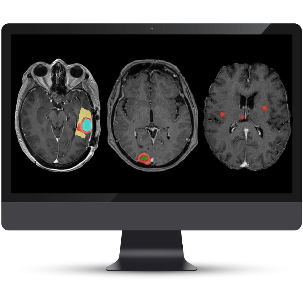 【美品・電子版使用済】Diagnostic Imaging: Brain 脳画像 41glTO+XU3L._SY200_QL15_.jpg