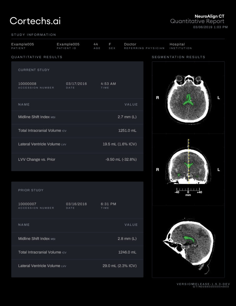Cortechs.ai | Enhancing Neuroimaging Insights: LVV & ICV Quantification and Midline Shift Indexing with NeuroAlign CT